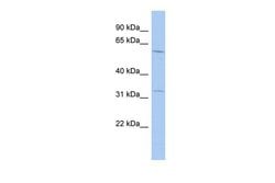 Invitrogen TRMT61B Polyclonal Antibody 100 &mu;L; Unconjugated:Antibodies,