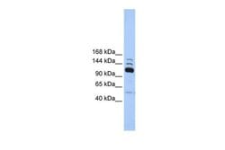 Invitrogen POLR3B Polyclonal Antibody 100 &mu;L; Unconjugated:Antibodies,