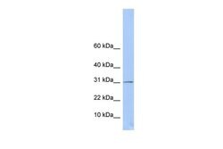 Invitrogen ECHDC1 Polyclonal Antibody 100 &mu;L; Unconjugated:Antibodies,