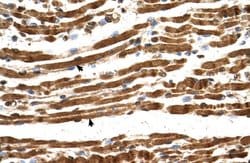 Invitrogen NAA16 Polyclonal Antibody 100 &mu;L; Unconjugated:Antibodies,