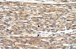 Invitrogen PNPLA3 Polyclonal Antibody 100 &mu;L | Buy Online | Invitrogen&trade; | Fisher Scientific