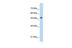 Invitrogen PNPLA3 Polyclonal Antibody 100 &mu;L | Buy Online | Invitrogen&trade; | Fisher Scientific