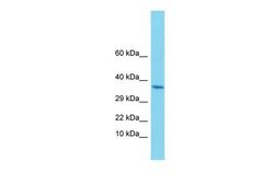 Invitrogen ALG1 Polyclonal Antibody 100 &mu;L; Unconjugated:Antibodies,