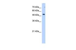 Invitrogen SULF2 Polyclonal Antibody 100 &mu;L; Unconjugated:Antibodies,