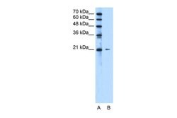 Invitrogen RAB5IF Polyclonal Antibody 100 &mu;L | Buy Online | Invitrogen&trade; | Fisher Scientific