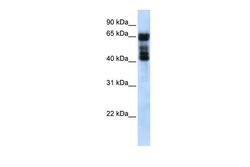 Invitrogen UGT2B4 Polyclonal Antibody 100 &mu;L; Unconjugated:Antibodies,