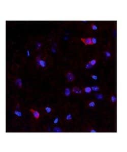 Invitrogen NTN4 Polyclonal Antibody 100 &mu;L | Buy Online | Invitrogen&trade; | Fisher Scientific