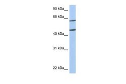 Invitrogen NTN4 Polyclonal Antibody 100 &mu;L | Buy Online | Invitrogen&trade; | Fisher Scientific
