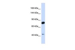 Invitrogen CDH23 Polyclonal Antibody 100 &mu;L; Unconjugated:Antibodies,