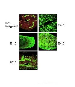 Invitrogen PORCN Polyclonal Antibody 100 &mu;L; Unconjugated:Antibodies,