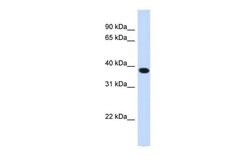 Invitrogen ACBD4 Polyclonal Antibody 100 &mu;L | Buy Online | Invitrogen&trade; | Fisher Scientific