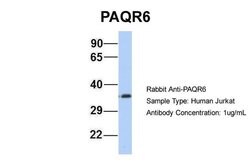 Invitrogen PAQR6 Polyclonal Antibody 100 &mu;L | Buy Online | Invitrogen&trade; | Fisher Scientific
