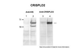 Invitrogen CRISPLD2 Polyclonal Antibody 100 &mu;L; Unconjugated:Antibodies,