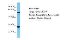 MGARP Polyclonal Antibody, Invitrogen 100 &mu;L; Unconjugated:Antibodies,