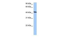 Invitrogen TMEM118 Polyclonal Antibody 100 &mu;L; Unconjugated:Antibodies,