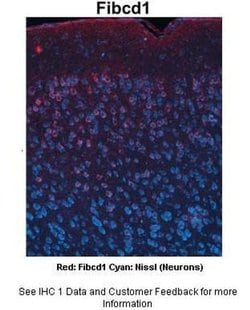 Invitrogen FIBCD1 Polyclonal Antibody 100 μL; Unconjugated:Antibodies,
