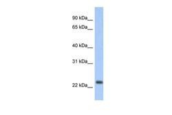 Invitrogen MT-ND6 Polyclonal Antibody 100 &mu;L; Unconjugated:Antibodies,
