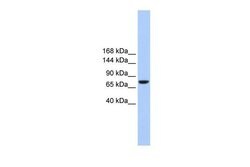 Invitrogen TMC2 Polyclonal Antibody 100 &mu;L | Buy Online | Invitrogen&trade; | Fisher Scientific