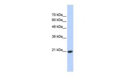 Invitrogen TCEAL8 Polyclonal Antibody 100 &mu;L | Buy Online | Invitrogen&trade; | Fisher Scientific