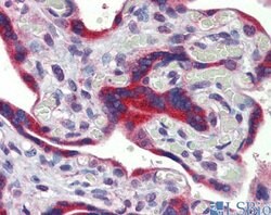 Invitrogen FEZF1 Polyclonal Antibody 100 &mu;L; Unconjugated:Antibodies,