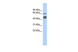Invitrogen ZNF578 Polyclonal Antibody 100 &mu;L | Buy Online | Invitrogen&trade; | Fisher Scientific