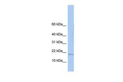 Invitrogen ZNHIT3 Polyclonal Antibody 100 &mu;L; Unconjugated:Antibodies,