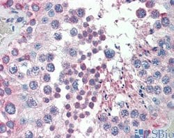 Invitrogen MED4 Polyclonal Antibody 100 &mu;L; Unconjugated:Antibodies,