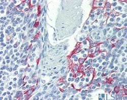 Invitrogen LIMD1 Polyclonal Antibody 100 &mu;L; Unconjugated:Antibodies,