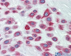 Invitrogen LIMD1 Polyclonal Antibody 100 &mu;L; Unconjugated:Antibodies,