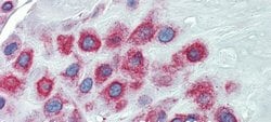 Invitrogen LIMD1 Polyclonal Antibody 100 &mu;L; Unconjugated:Antibodies,