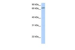 Invitrogen ZNF418 Polyclonal Antibody 100 μL; Unconjugated:Antibodies,