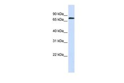 Invitrogen ZNF714 Polyclonal Antibody 100 &mu;L | Buy Online | Invitrogen&trade; | Fisher Scientific