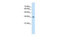 Invitrogen MAS1 Polyclonal Antibody 100 &mu;L; Unconjugated:Antibodies,