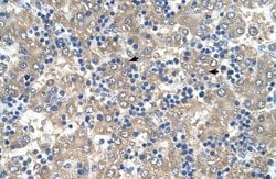 Invitrogen C3orf10 Polyclonal Antibody 100 &mu;L; Unconjugated:Antibodies,