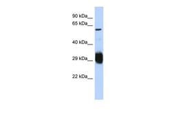 Invitrogen SETMAR Polyclonal Antibody 100 &mu;L; Unconjugated:Antibodies,