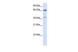 Invitrogen CCDC19 Polyclonal Antibody 100 &mu;L; Unconjugated:Antibodies,