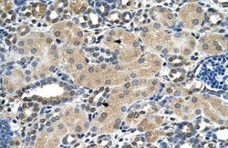 Invitrogen ASPH Polyclonal Antibody 100 &mu;L; Unconjugated:Antibodies,