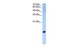 Invitrogen HIST2H2AC Polyclonal Antibody 100 &mu;L; Unconjugated:Antibodies,