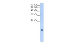 Invitrogen HIST2H2AA3 Polyclonal Antibody 100 &mu;L; Unconjugated:Antibodies,