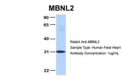 Invitrogen MBNL2 Polyclonal Antibody 100 &mu;L; Unconjugated:Antibodies,