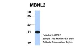 Invitrogen MBNL2 Polyclonal Antibody 100 &mu;L; Unconjugated:Antibodies,