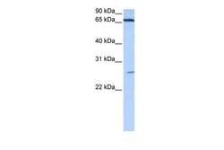 Invitrogen ZNF879 Polyclonal Antibody 100 &mu;L; Unconjugated:Antibodies,