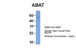 Invitrogen ABAT Polyclonal Antibody 100 &mu;L; Unconjugated:Antibodies,