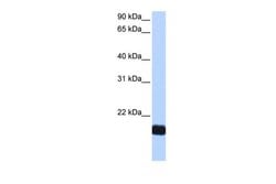 Invitrogen Cardiotrophin 1 Polyclonal Antibody 100 &mu;L; Unconjugated:Antibodies,
