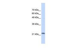 Invitrogen RASL10A Polyclonal Antibody 100 &mu;L; Unconjugated:Antibodies,