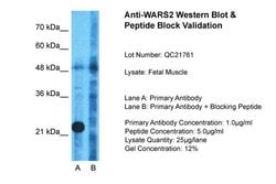 Invitrogen WARS2 Polyclonal Antibody 100 &mu;L; Unconjugated:Antibodies,