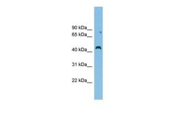 Invitrogen CCBE1 Polyclonal Antibody 100 &mu;L; Unconjugated:Anticuerpos