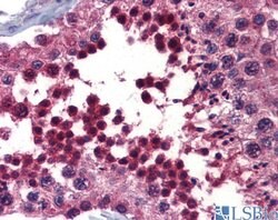 Invitrogen hCV-2 Polyclonal Antibody 100 &mu;L; Unconjugated:Antibodies,