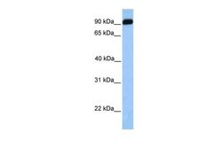 Invitrogen hCV-2 Polyclonal Antibody 100 &mu;L; Unconjugated:Antibodies,