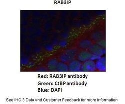 Invitrogen RAB3IP Polyclonal Antibody 100 &mu;L; Unconjugated:Antibodies,